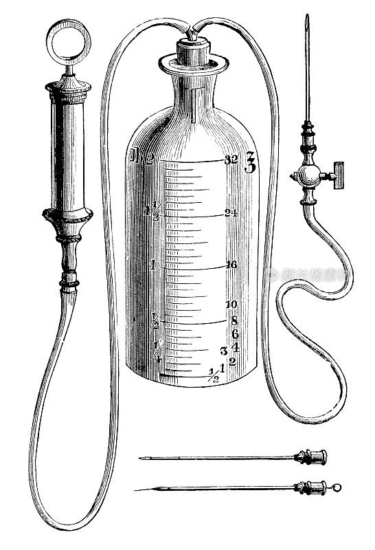 维多利亚时代的医疗设备，手动吸痰器- 19世纪